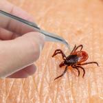 Fingers removing a tick from skin