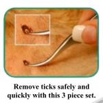 Removing a tick Kit: Stainless Steel Tick Removal